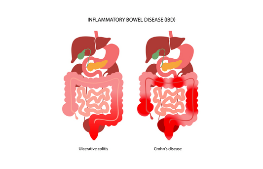 Probiotics in Ulcerative Colitis, Crohn’s Disease, and Pouchitis: A Meta-Analysis of Their Role in Inducing and Maintaining Remission