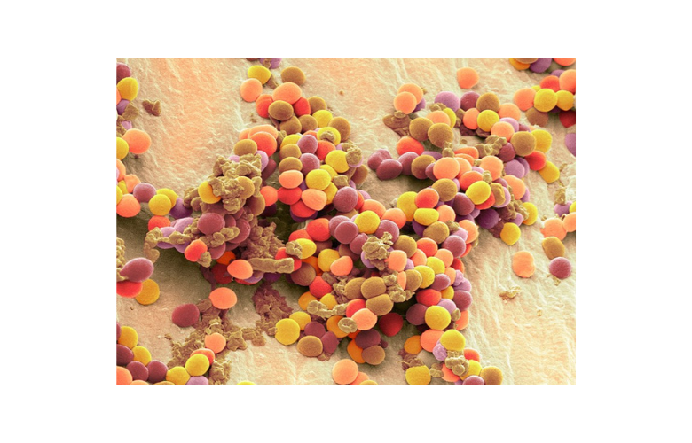 Enhancing Gastrointestinal Health with Lactobacillus reuteri NCIMB 30242: A Post-Hoc Analysis of a Randomized Controlled Trial